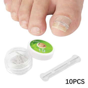 10шт Наклейки для коррекции ногтей 13-20 мм, Пластыри для коррекции вросших ногтей, Пластыри для лечения Паронихии, Восстанавливающий Корректор, Инструменты для педикюра 4