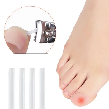 Лечение Паронихии большого пальца стопы для мужчин, Педикюр, Корректор для ногтей Groove Ortho, подушечки для коррекции вросших ногтей 2